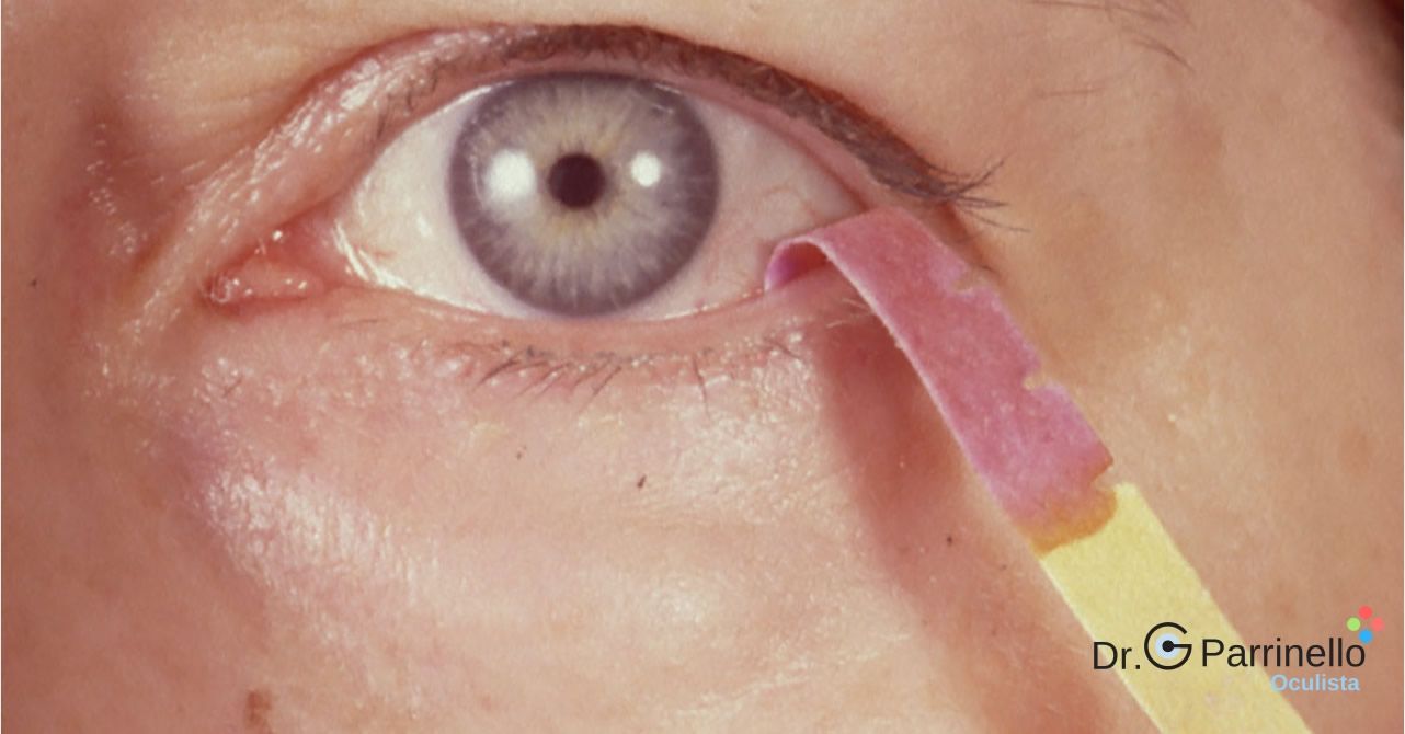 Test di Schirmer Diagnosi ed esami visivi - oculista Marsala Test di Schirmer